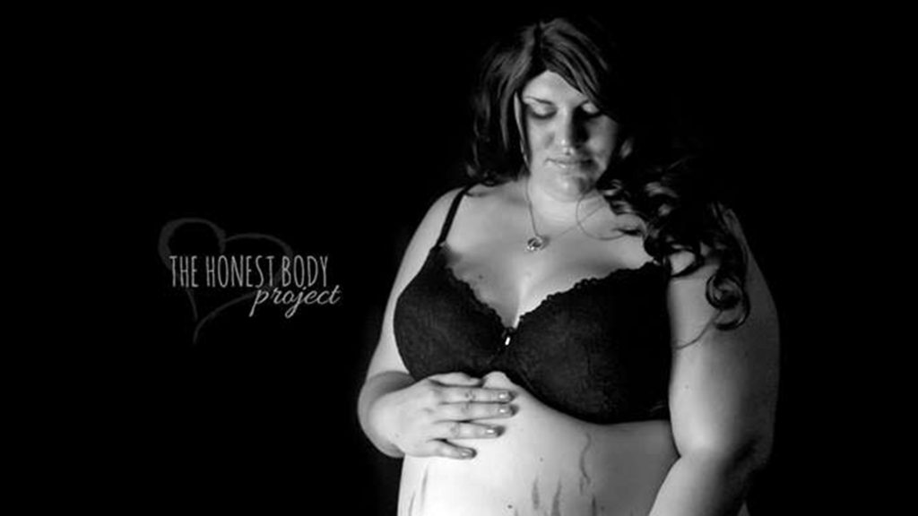 Brittany Dykstra, pregnant woman who was body shamed, and was photographed as part of The Honest Body Project.